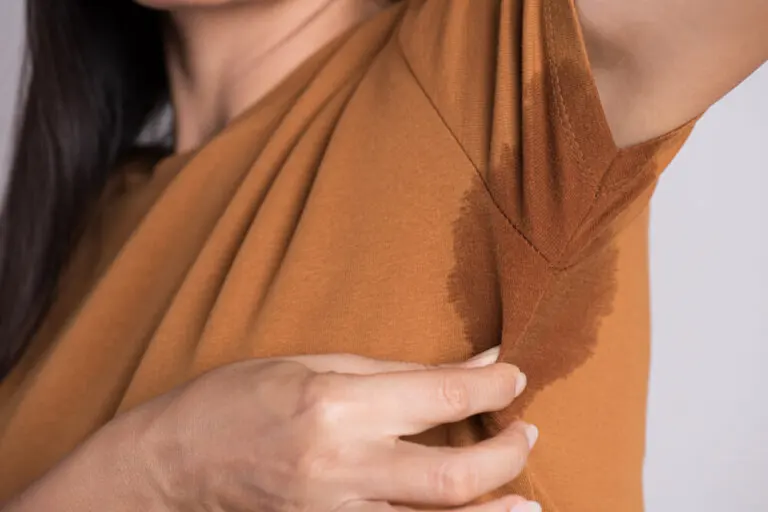 Hiperhidrosis: causas y síntomas