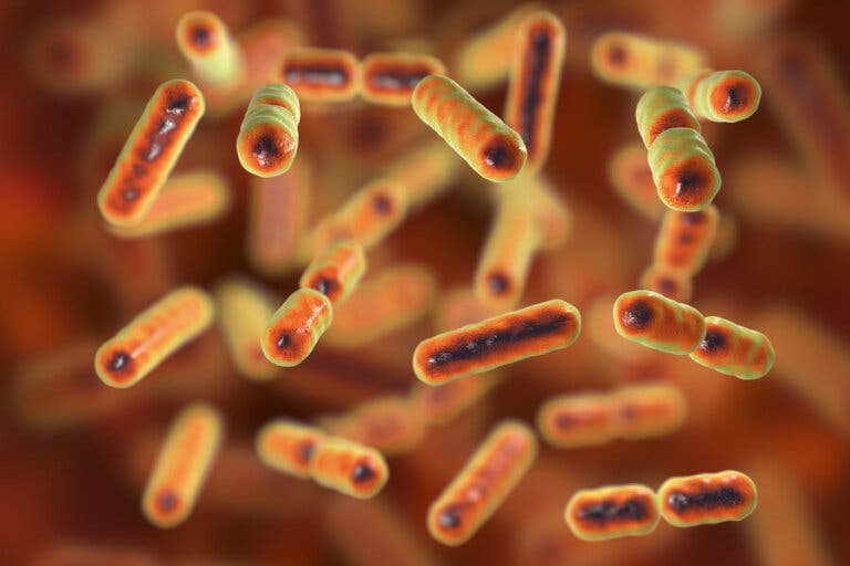 ¿Qué es la disbiosis intestinal?