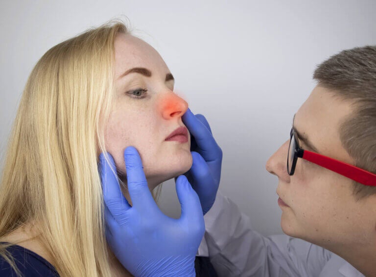 Pólipos en la nariz: síntomas, causas y tratamiento