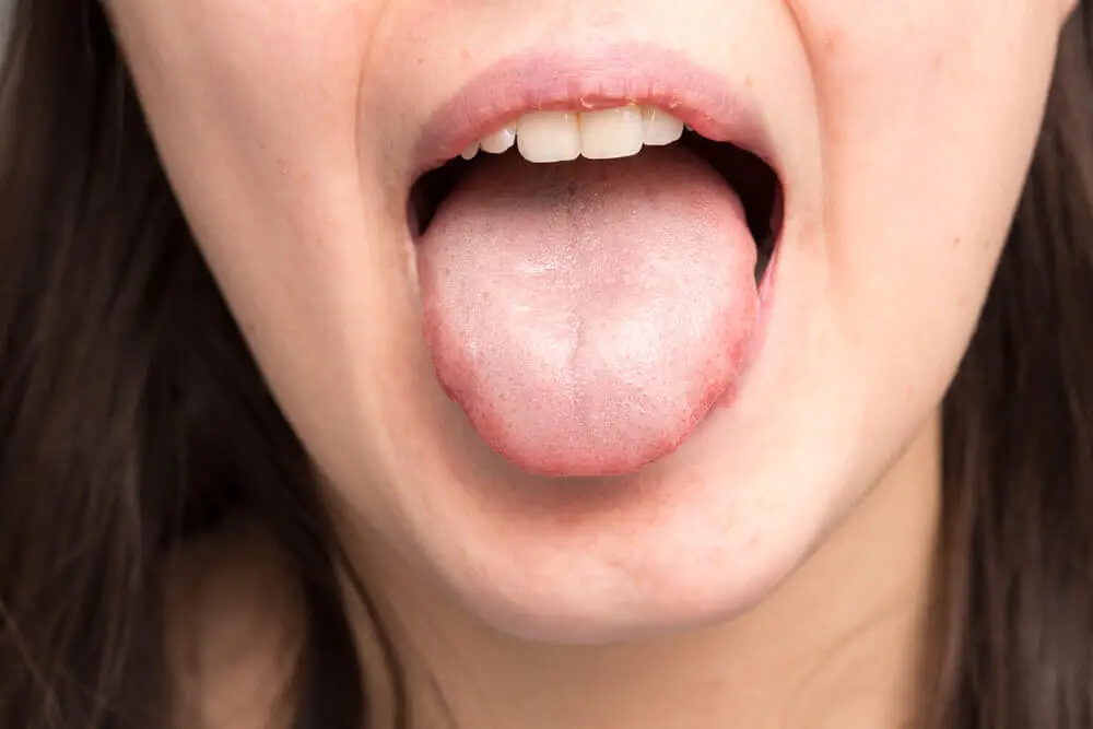 Causas de la saliva espesa