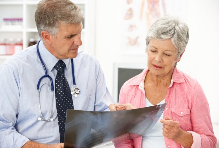 Osteoporosis posmenopáusica: causas y tratamiento