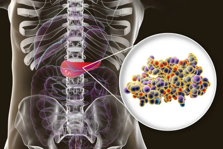 Insulina: ¿qué es y para qué sirve?