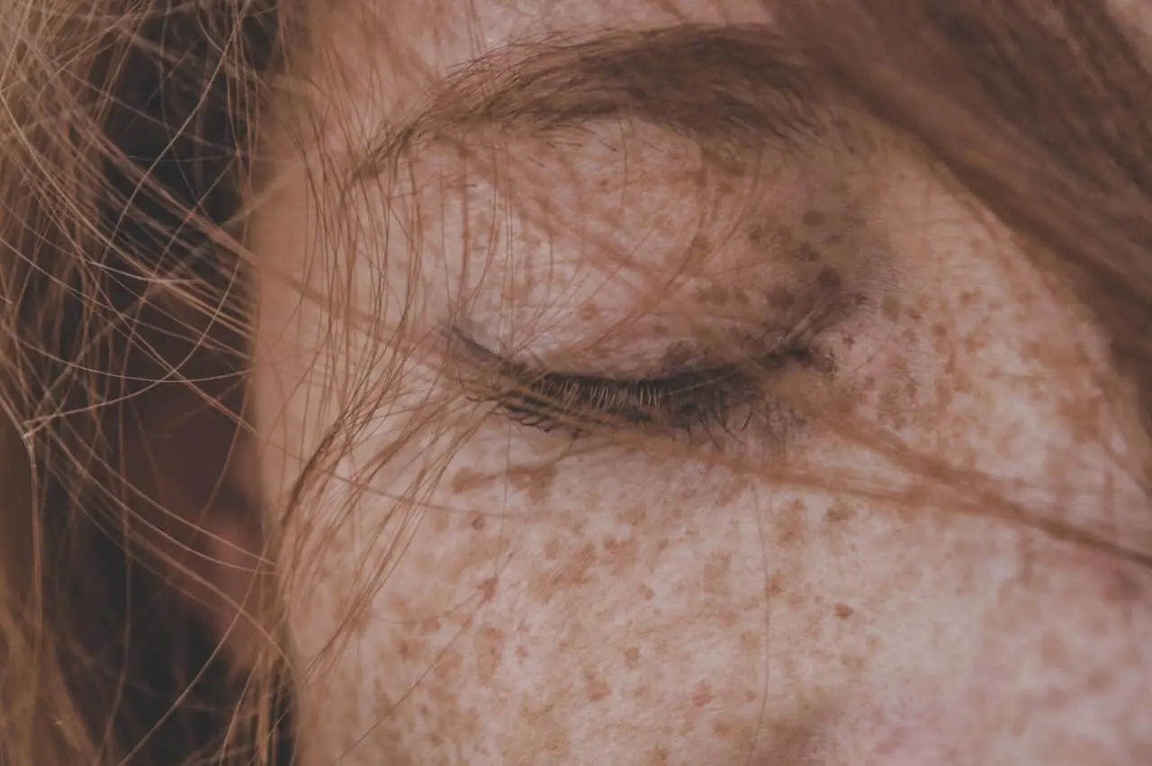 Mujer con pecas.