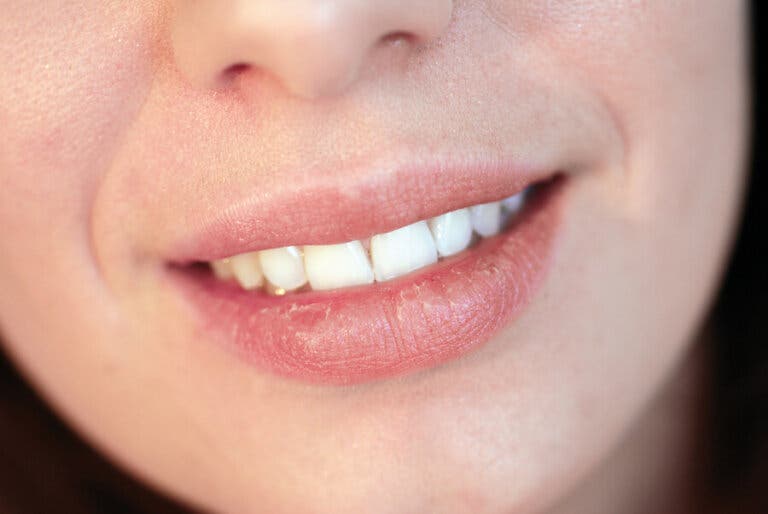¿Por qué se resecan los labios?