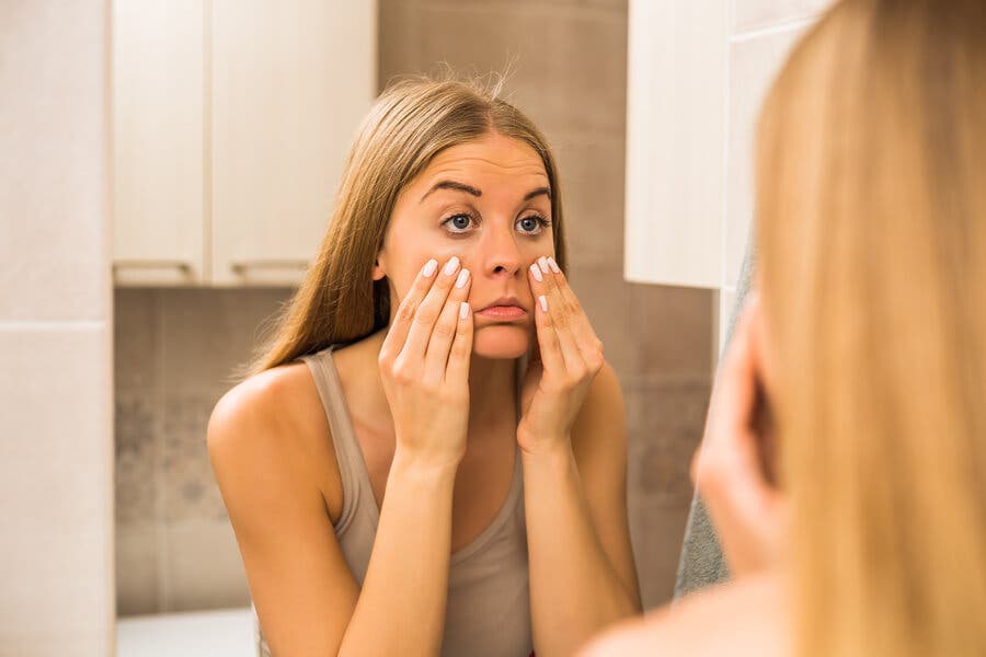 ¿Por qué salen las ojeras?