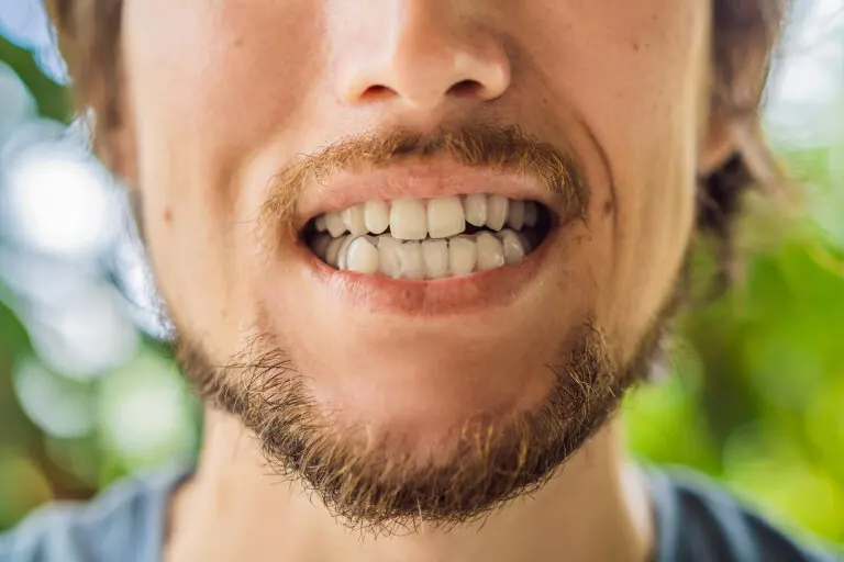 ¿Qué es el bruxismo y cómo se detecta?