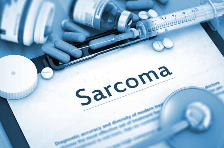 ¿Qué es un sarcoma?