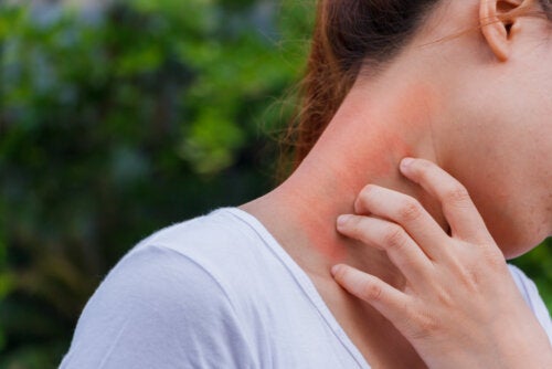 Dermatitis y corticoides ¿cómo se relacionan?