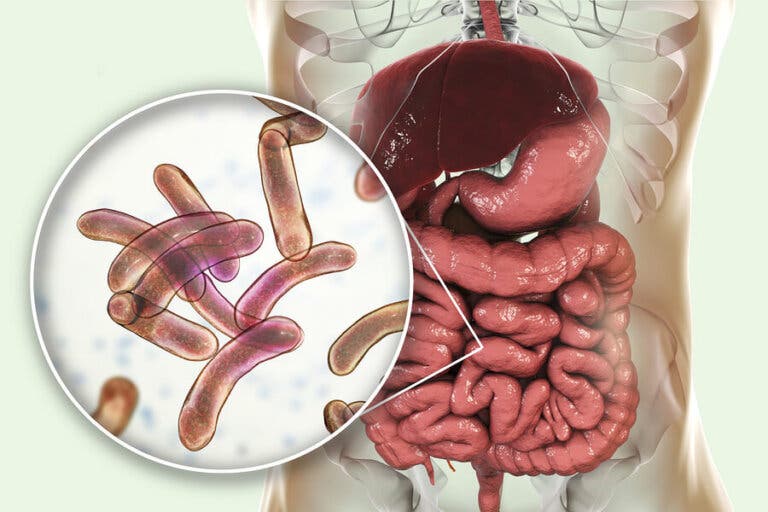 Tratamiento para el sobrecrecimiento bacteriano