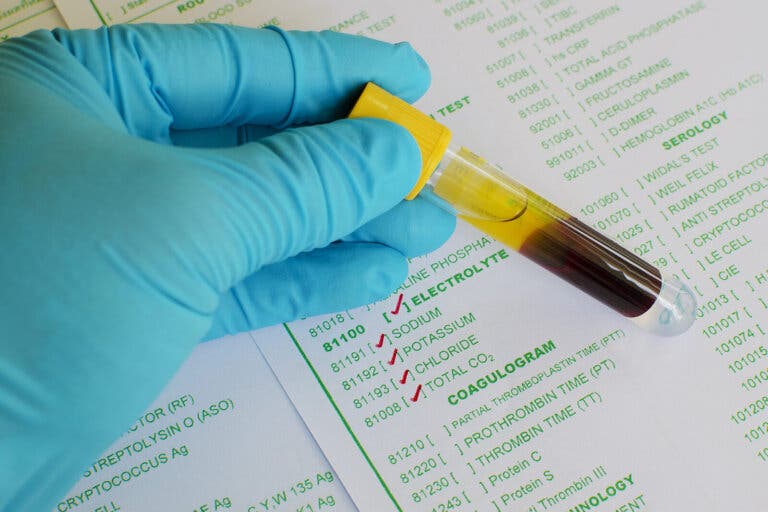 ¿Qué son los electrolitos?