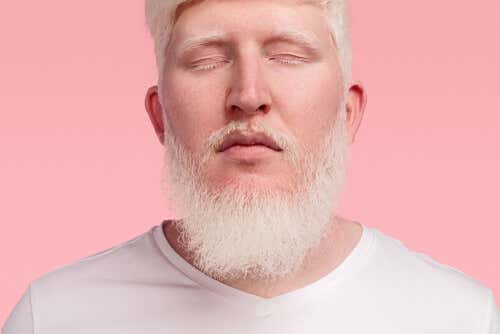 cabello barba albino
