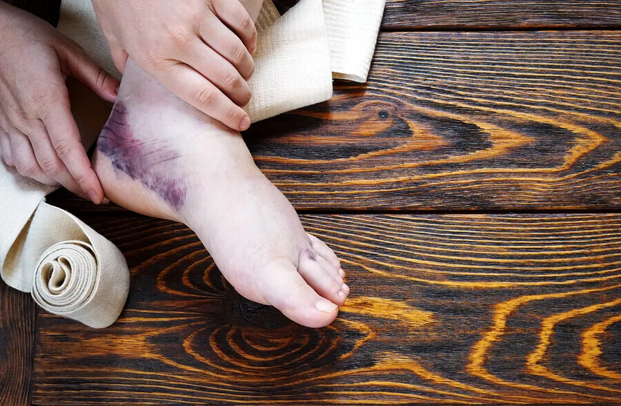 Hematoma y esguince de tobillo