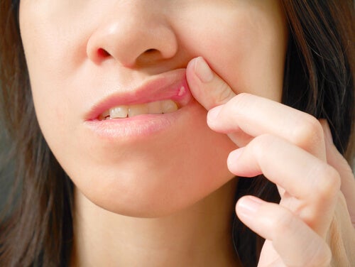 Heridas en la boca: causas y tratamientos