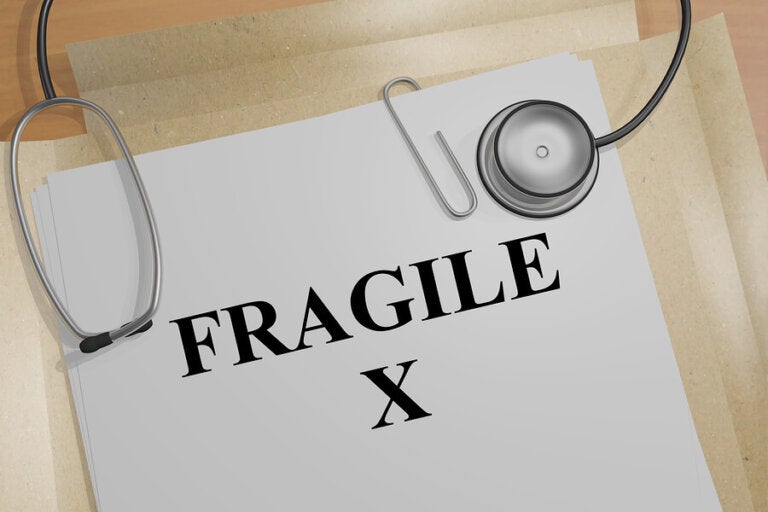 Síndrome X frágil: síntomas y tratamientos