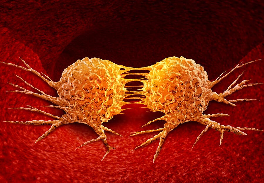 Origen del cáncer