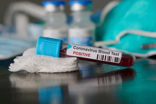 Posible caso de coronavirus en Brasil, el primero de América Latina