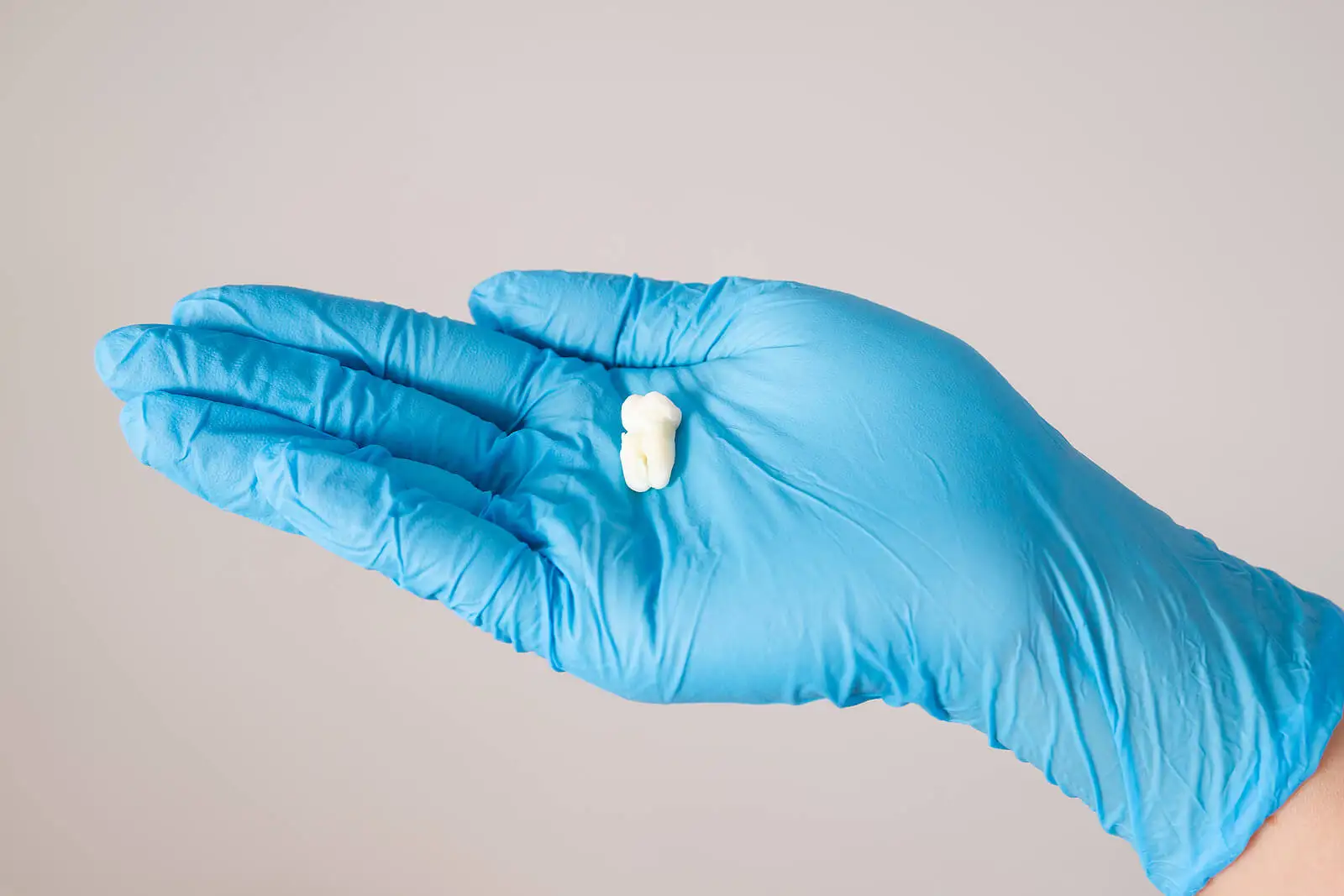 Extracción de dientes para la ortodoncia.