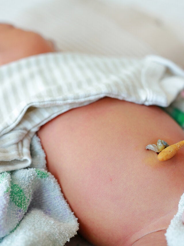 Cuidados Del Ombligo Del Recien Nacido Mejor Con Salud