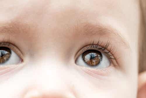 El glaucoma infantil