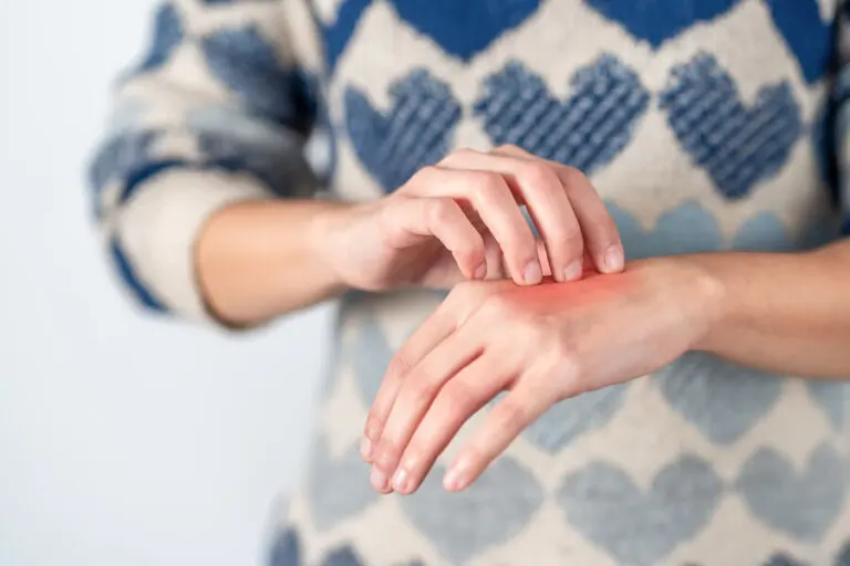 ¿Qué es el granuloma anular?