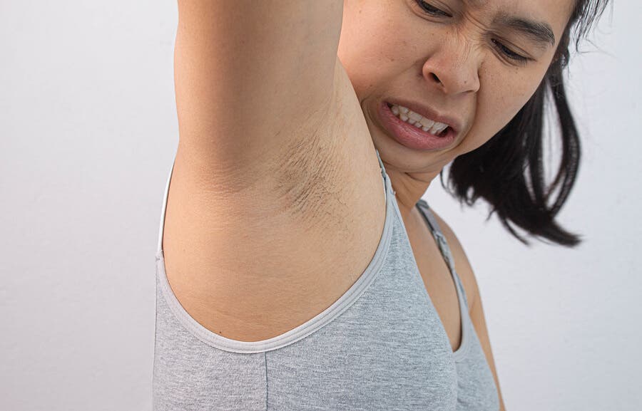 Mujer manchas por poca higiene