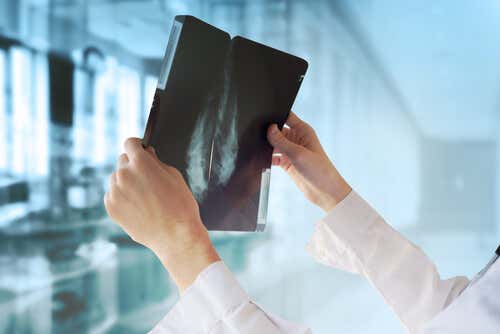 Dokter bekijkt een röntgenfoto