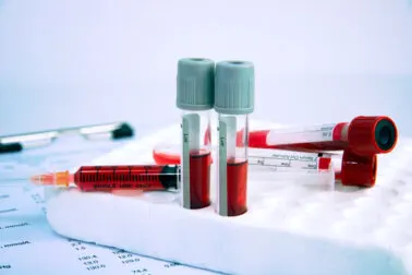 Enfermedades hematológicas: todo lo que debes saber