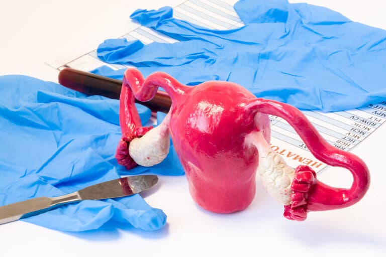 Tipos de histerectomía