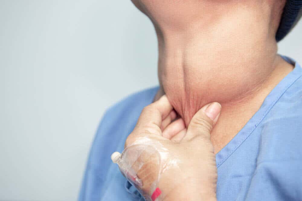 Síntomas del cáncer de tiroides 