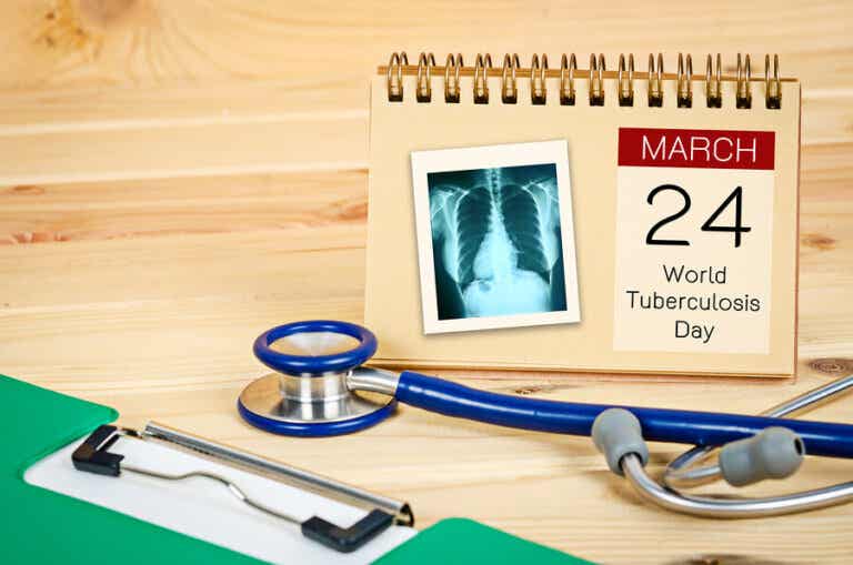 Día Mundial de la Tuberculosis: es hora de actuar