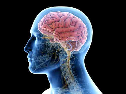 tejido cerebral afectado por encefalitis