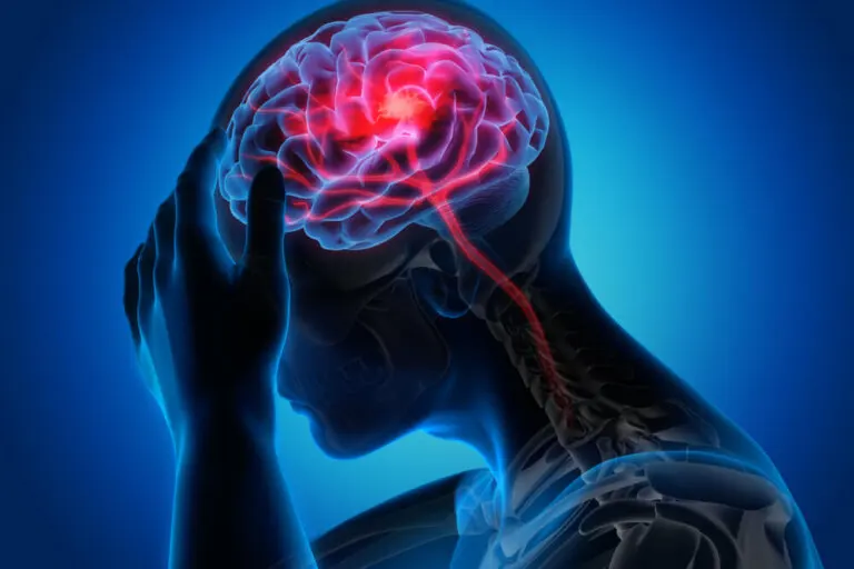 ¿El cerebro puede sentir dolor?
