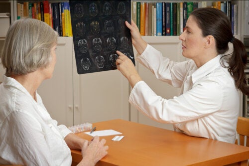 Embolia cerebral: ¿qué es y cómo afecta?