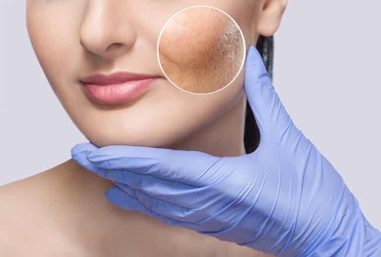 Microbioma de la piel: ¿por qué es tan importante?