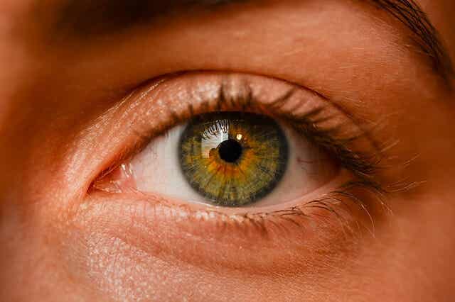 Nevus oculares: ¿son peligrosos?