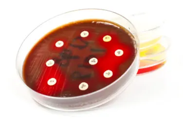 Antibiograma: ¿para qué se usa?
