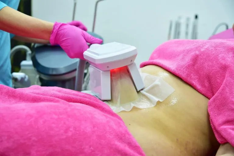 Criolipólisis: ¿en qué consiste y para qué sirve?