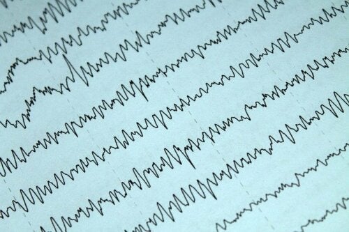 Epilepsia y lactancia materna