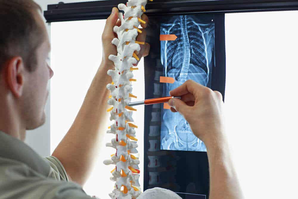 røntgen av skoliotisk stilling