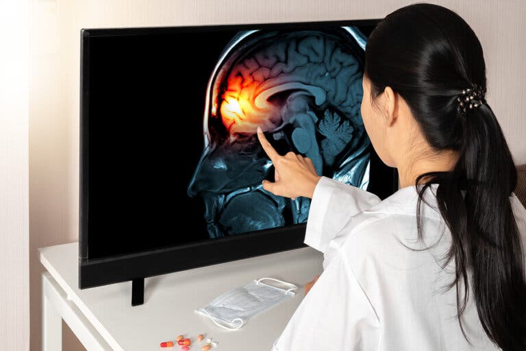 Meninges: ¿qué son y para qué sirven?