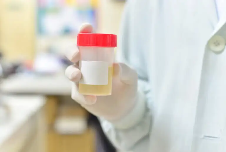 Orina después del ejercicio: ¿qué debes saber?