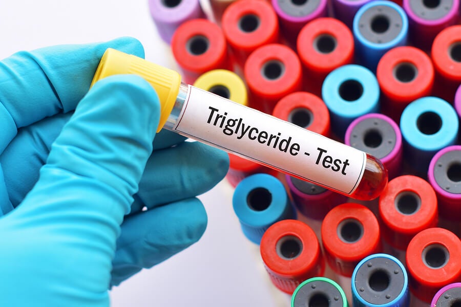 Test des triglycérides
