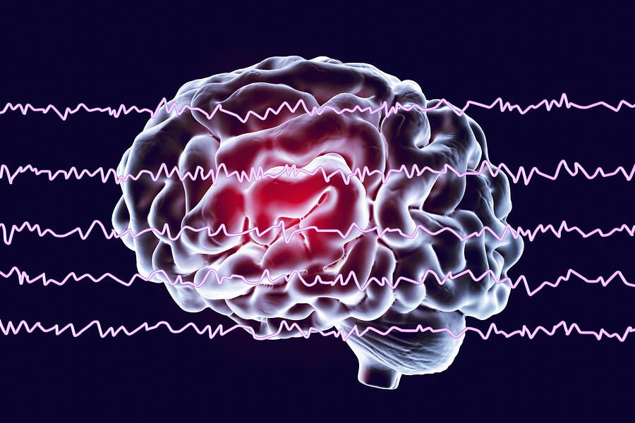 Ondas cerebrales y sueño REM