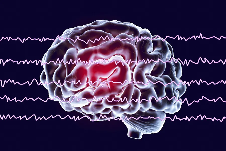 Ondas cerebrales y sueño REM