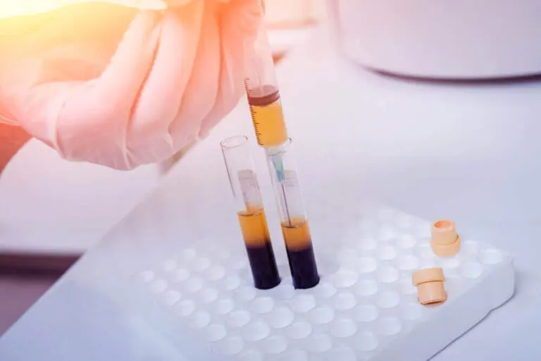 Plasmaféresis: ¿qué es y cuándo es necesaria?