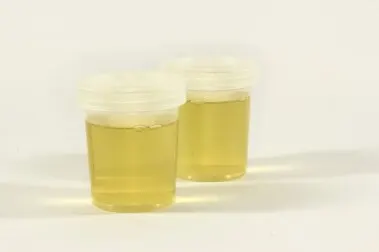 Infecciones de las vías urinarias