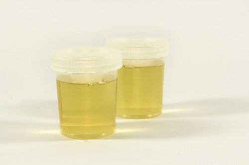 Infecciones de las vías urinarias