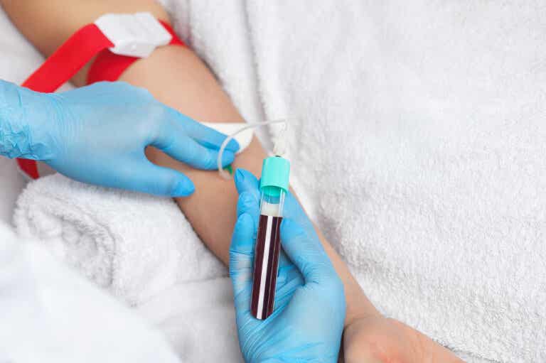 ¿Qué es la transfusión de plasma?