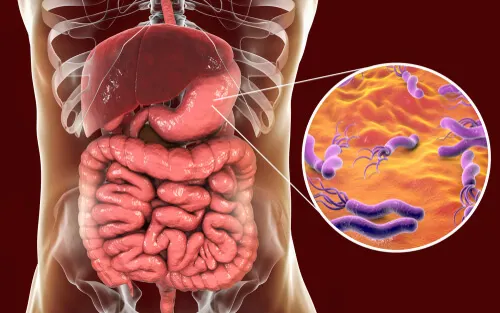 H. pylori en el estómago