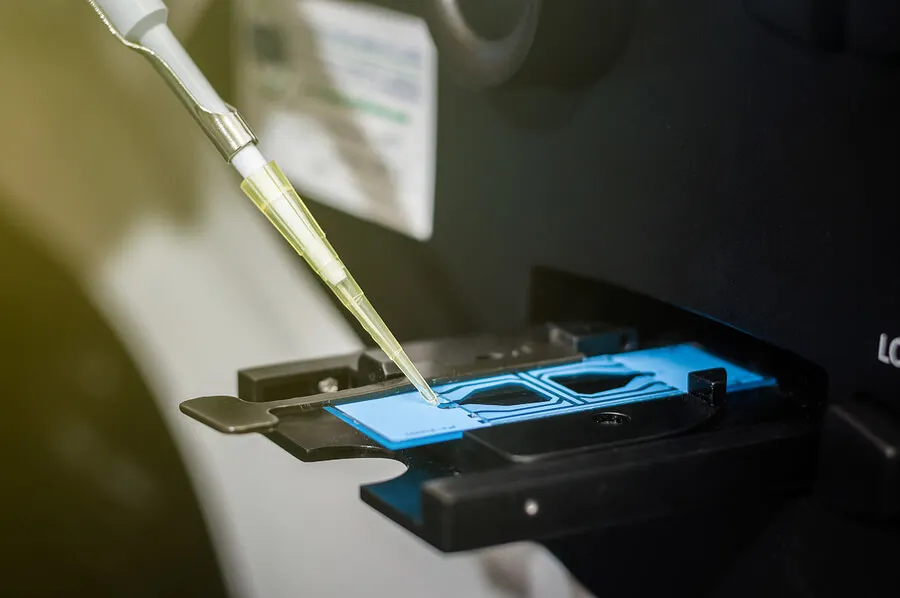 analiza plemników pod kątem żylaków powrózka nasiennego